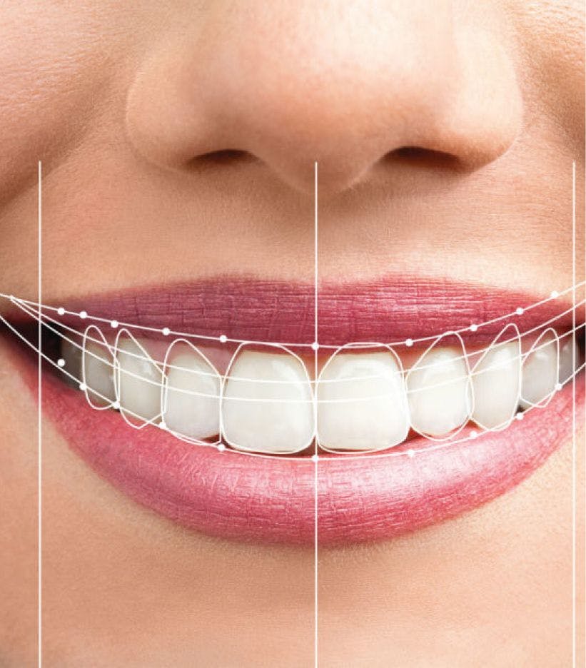 Smiling mouth with teeth open and teeth structure trace overlay